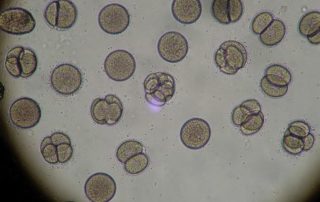 Pseudomonas Aeruginosa Biofilm DNA Analysis Chronic Sinusitis