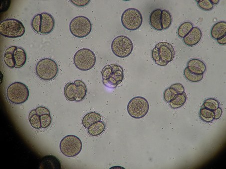 Pseudomonas Aeruginosa Biofilm DNA Analysis Chronic Sinusitis