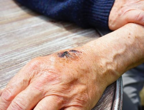 When a MRSA Infection is Not MRSA